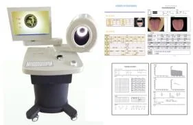 System ( TCM )