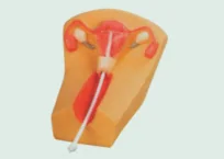 Female Intrauterine Contraception Training Model