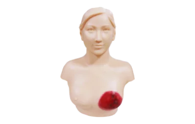 Advanced Breast Carbuncle Diagnosis Training Model