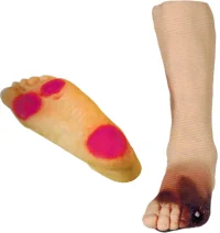 Diabetic Foot Demonstration Model