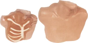 Central Venous Puncture and Catheterization Model
