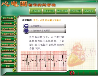 Updated ECG Teaching Software