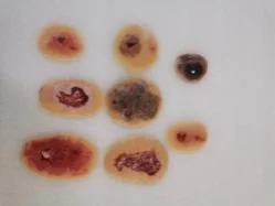 TCM Surgical Disease Model Set