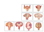 Obstetrics and Gynecology Training Model - Item 18016