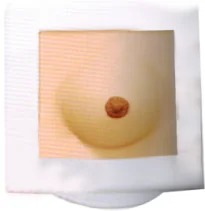 Breast Operation Model