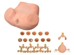 Advanced Obstetrics and Gynecology Model