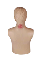 Advanced Carbuncle Diagnosis Model
