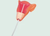 Advanced Intrauterine Contraception Training Model